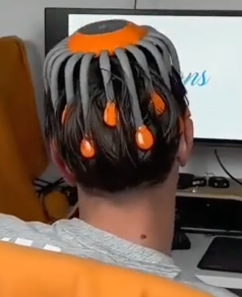 ggfdf
